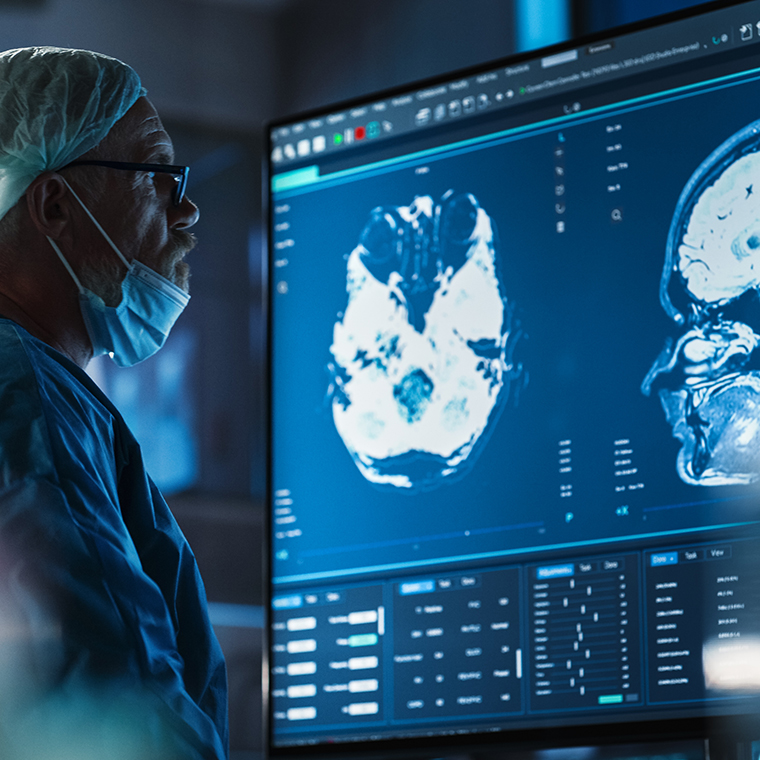 Cirugía de precisión: imagenología vs tumores cerebrales